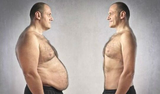 Men and women want to get rid of a big abdomen
